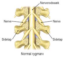 http://www.aleris.dk/Global/da/Specialer/Rygkirurgi/Rygmarv_normal.jpg